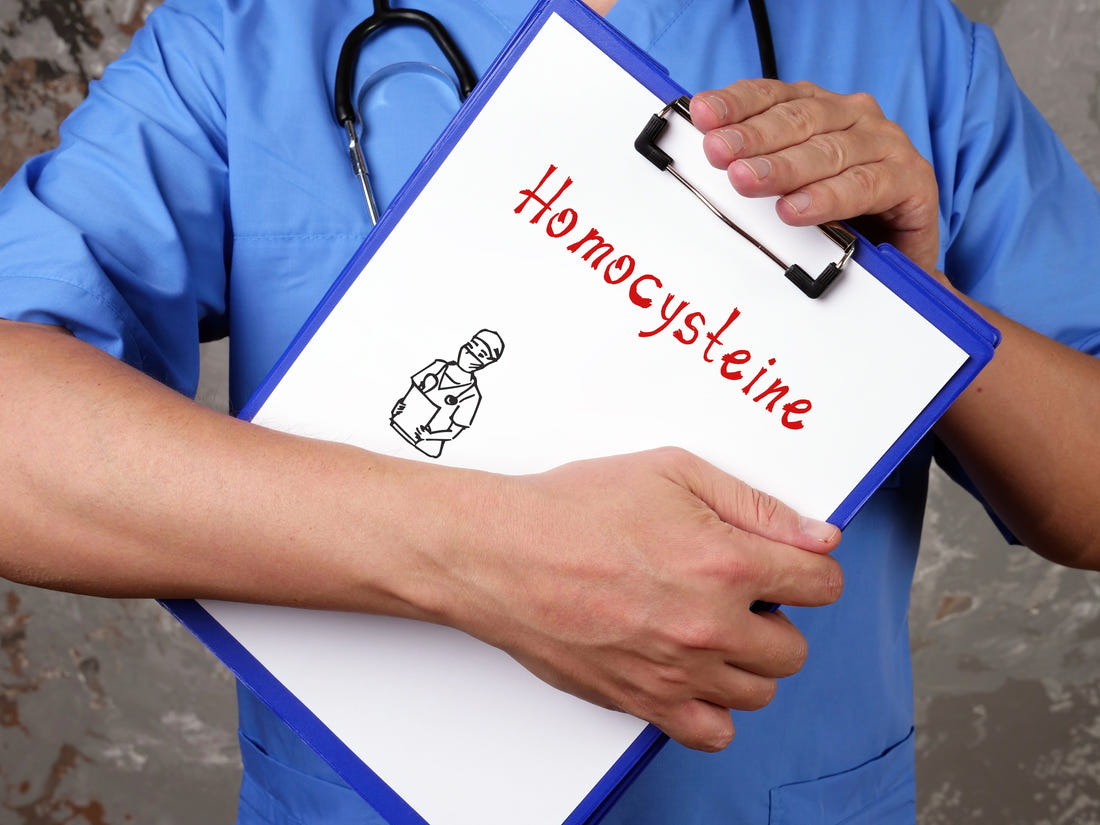 Elevated Homocysteine Levels or Lab Error?