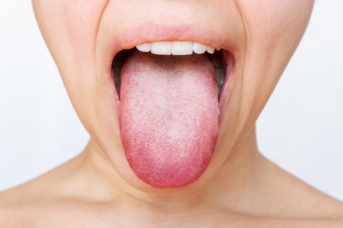 Methylation Inhibition Caused by Candida Toxin