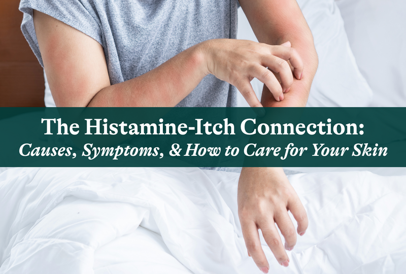 Histamine Intolerance and How to Support Healthy Histamine Levels Seeking Health Histamine Intolerance and How to Support Healthy Histamine Levels Seeking Health