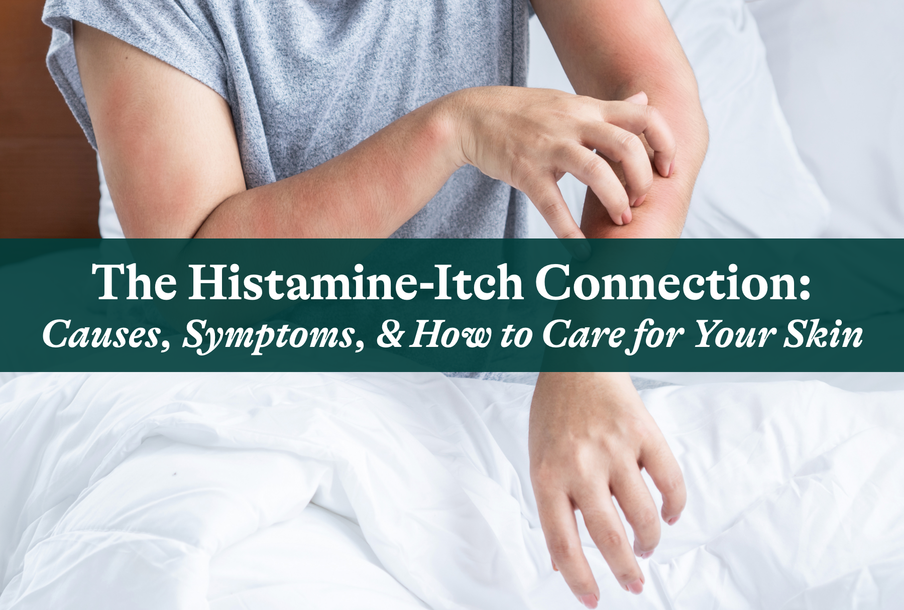 The Histamine-Itch Connection: Causes, Symptoms, and How to Care for Your Skin
