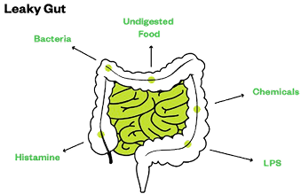 acetyl-l-carnitine leaky gut Acetyl L Carnitine Seeking Health Acetyl-L-Carnitine - Acetyl-L-Carnitine